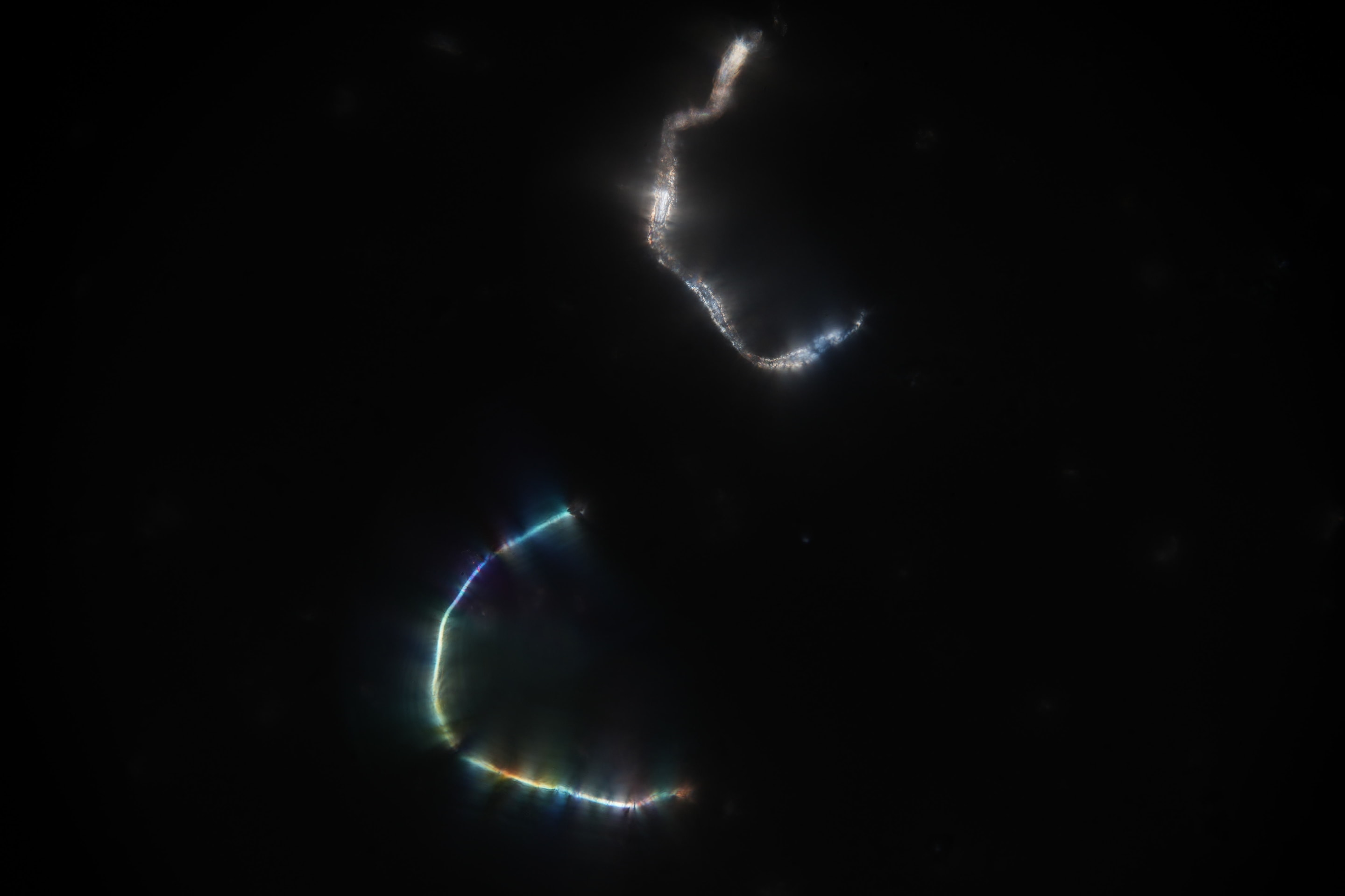 Two pieces of lint upon a microscope's specimen slide catch light beautifully